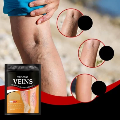 Patch de traitement des varices